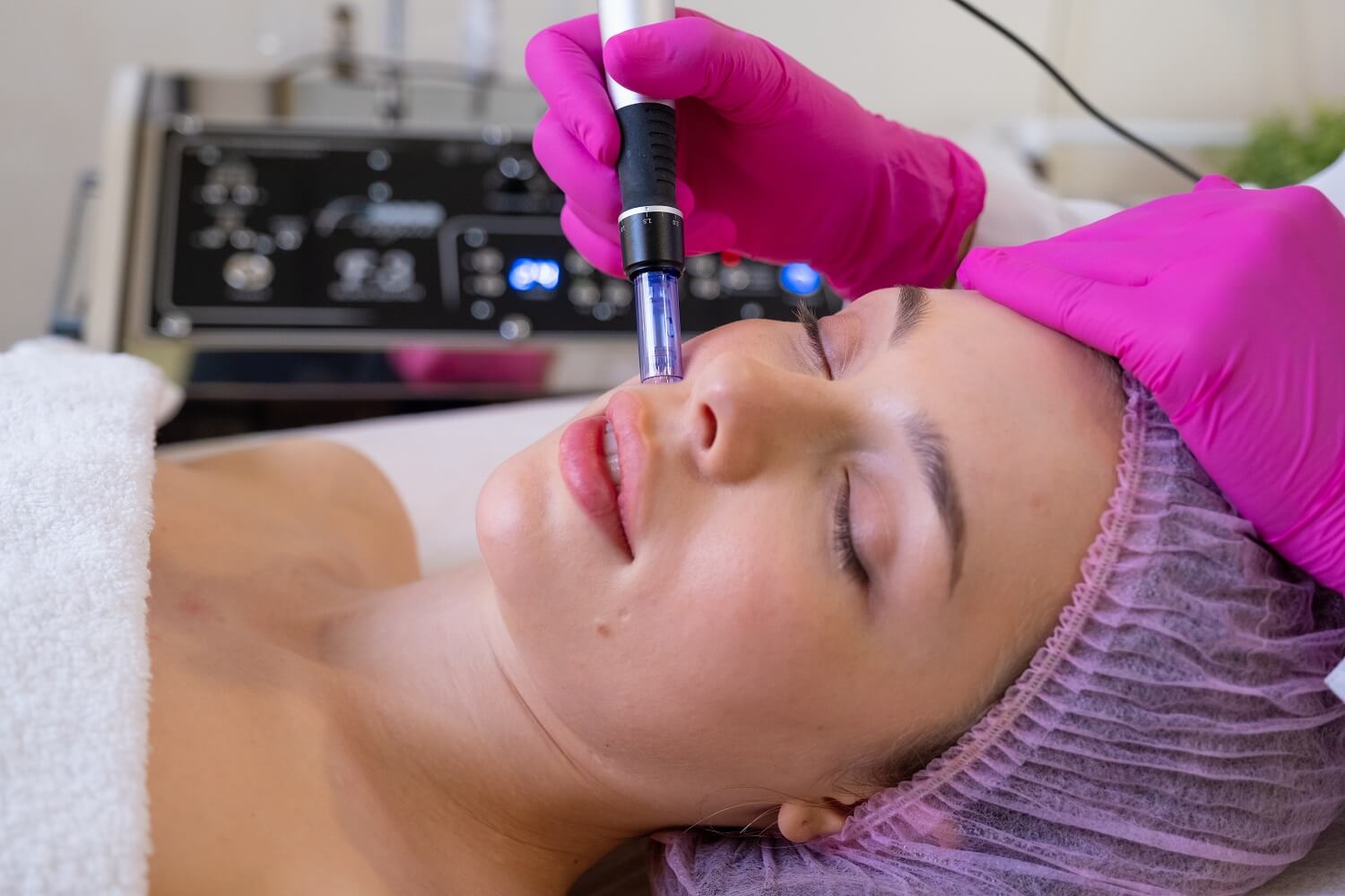 Микронидлинг процедура от козметично студио EDEN beauty and care във Варна Микронидлинг процедура от козметично студио EDEN beauty and care във Варна